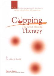 Cupping - The Great Missing Therapy